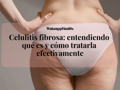 Celulitis fibrosa: entendiendo qué es y cómo tratarla efectivamente