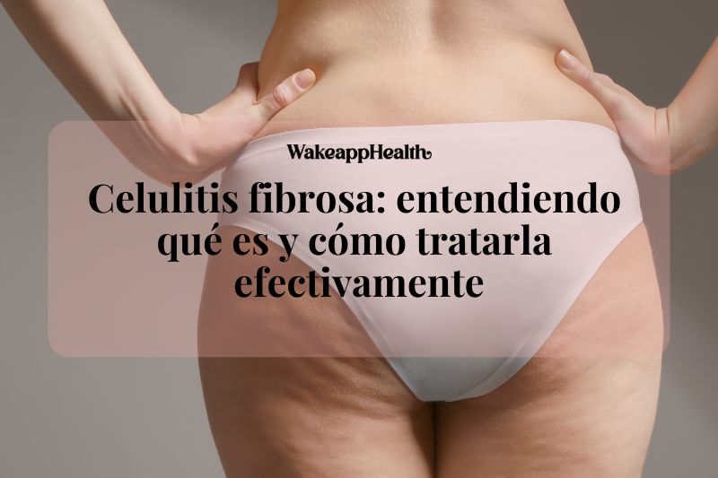 Celulitis fibrosa: entendiendo qué es y cómo tratarla efectivamente Celulitis fibrosa: entendiendo qué es y cómo tratarla efectivamente