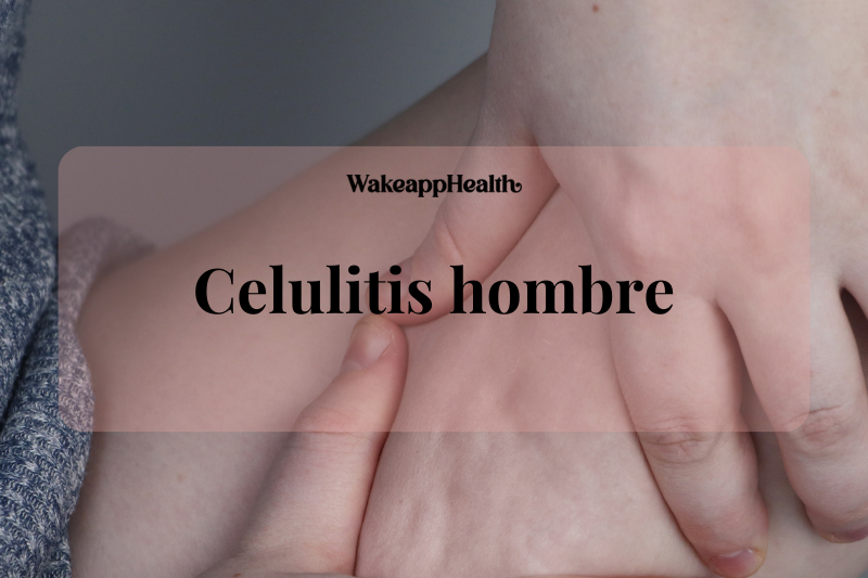 Celulitis en hombres: qué necesitas saber y tratamientos