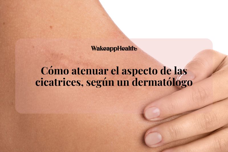 Cómo atenuar el aspecto de las cicatrices, según un dermatólogo