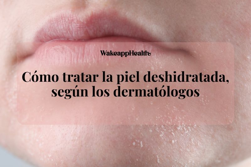 Cómo tratar la piel deshidratada, según los dermatólogos