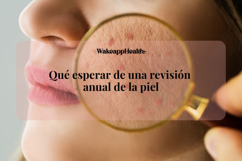 Qué esperar de una revisión anual de la piel