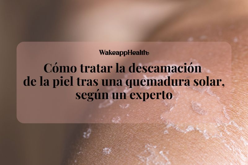 Cómo tratar la descamación de la piel tras una quemadura solar, según un experto